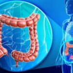 Deteksi Kanker Usus dengan Virtual Colonoscopy, Nykondusif dan Cepat