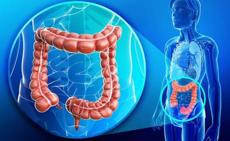 Deteksi Kanker Usus dengan Virtual Colonoscopy, Nykondusif dan Cepat